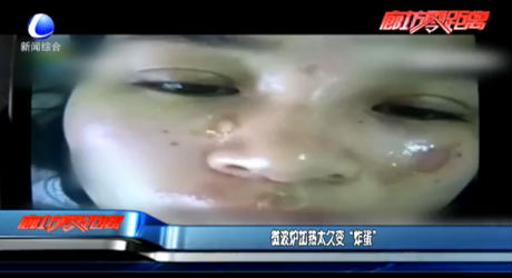 微波爐加熱太久變“炸蛋”