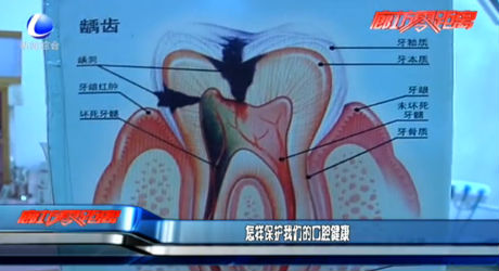 怎樣保護(hù)我們的口腔健康